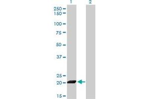Image no. 2 for anti-Interferon Stimulated Exonuclease Gene 20kDa (ISG20) (AA 1-181) antibody (ABIN561532)