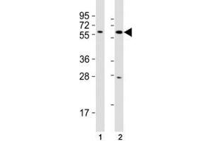 Image no. 4 for anti-SRY (Sex Determining Region Y)-Box 10 (SOX10) (AA 231-259) antibody (ABIN3032721)