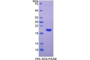 Image no. 1 for Superoxide Dismutase 1, Soluble (SOD1) (AA 2-152) protein (His tag) (ABIN6238043)