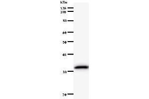 Image no. 1 for anti-Endonuclease 8-like 2 (NEIL2) antibody (ABIN933141)