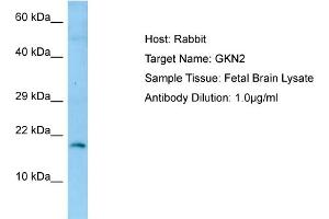 Image no. 1 for anti-Gastrokine 2 (GKN2) (N-Term) antibody (ABIN2790149)