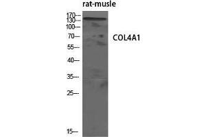 Image no. 2 for anti-Collagen, Type IV, alpha 1 (COL4A1) (N-Term) antibody (ABIN3184012)