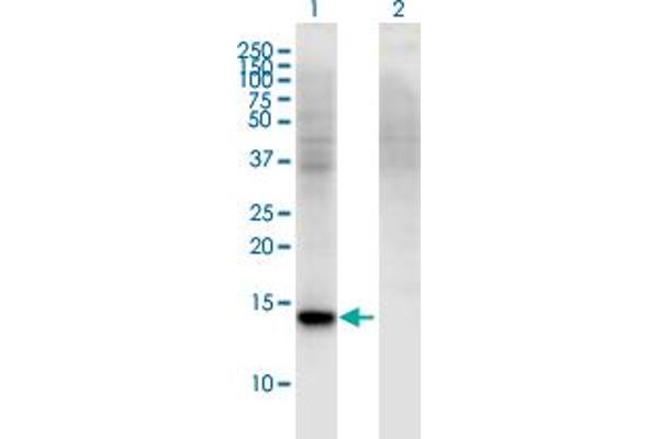 anti-Retinol Binding Protein 7, Cellular (RBP7) (AA 35-134) antibody