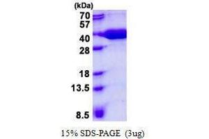 Image no. 1 for Prefoldin Subunit 3 (PFDN3) protein (ABIN2132496)