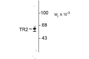 Image no. 1 for anti-Nuclear Receptor Subfamily 2, Group C, Member 1 (NR2C1) (N-Term) antibody (ABIN361367)