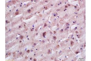 Formalin-fixed and paraffin embedded rat brain labeled with Anti-TACO1 Polyclonal Antibody, Unconjugated  at 1:200 followed by conjugation to the secondary antibody and DAB staining.