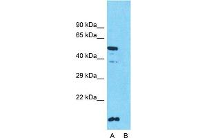 Image no. 2 for anti-Solute Carrier Family 10 (Sodium/bile Acid Cotransporter Family), Member 1 (SLC10A1) (Middle Region) antibody (ABIN2777141)