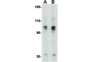 Image no. 1 for anti-SLIT and NTRK-Like Family, Member 6 (SLITRK6) (C-Term) antibody (ABIN6656783)