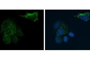 Image no. 4 for anti-CD81 (CD81) (Center) antibody (ABIN2855163)