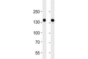 Image no. 5 for anti-Fms-Related Tyrosine Kinase 4 (FLT4) antibody (ABIN3030977)