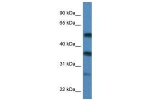 Image no. 1 for anti-SERPINE1 mRNA Binding Protein 1 (SERBP1) (C-Term) antibody (ABIN2778738)