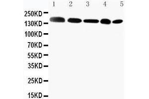 Anti-Gli2 antibody, Western blotting Lane 1: MCF-7 Cell Lysate Lane 2: HELA Cell Lysate Lane 3: SKOV Cell Lysate Lane 4:  Cell Lysate Lane 5: A549 Cell Lysate