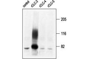 Western blot analysis of membranes from Xenopus oocytes, expressing CLC-3, CLC-4, and CLC-5, using Anti-CLC-3 (CLCN3) Antibody (ABIN7043052, ABIN7044121 and ABIN7044122) (kindly provided by Prof.