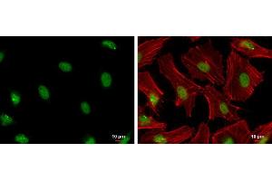 Image no. 5 for anti-Proliferating Cell Nuclear Antigen (PCNA) (Center) antibody (ABIN2854788)