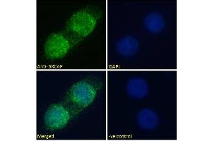 Image no. 1 for anti-Snf2-Related CREBBP Activator Protein (SRCAP) (Internal Region) antibody (ABIN570790)