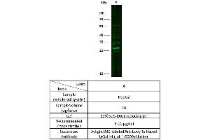 Image no. 1 for anti-phosphoribosyl Transferase Domain Containing 1 (PRTFDC1) (AA 1-225) antibody (ABIN2692855)