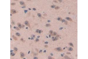 Image no. 2 for anti-Neuromedin B (AA 8-114) antibody (ABIN1077703)