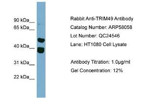 Image no. 2 for anti-Tripartite Motif Containing 49 (TRIM49) (Middle Region) antibody (ABIN2787531)