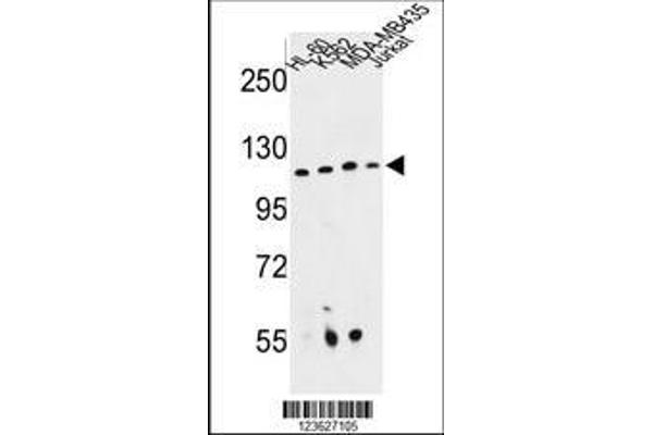 anti-Retinitis Pigmentosa GTPase Regulator Interacting Protein 1 (RPGRIP1) (AA 530-557) antibody