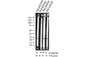 Image no. 2 for anti-Caveolin 1, Caveolae Protein, 22kDa (CAV1) (pTyr14) antibody (ABIN6255810)