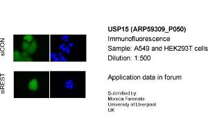 Image no. 2 for anti-Ubiquitin Specific Peptidase 15 (USP15) (C-Term) antibody (ABIN2788019)