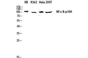Image no. 3 for anti-Nuclear Factor of kappa Light Polypeptide Gene Enhancer in B-Cells 2 (NFKB2) (Thr160) antibody (ABIN3185875)