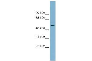 Image no. 1 for anti-Trimethyllysine Hydroxylase, epsilon (TMLHE) (Middle Region) antibody (ABIN2774177)