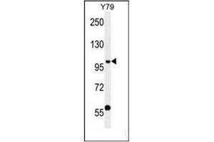 Image no. 2 for anti-PHD Finger Protein 20 (PHF20) (AA 130-159), (N-Term) antibody (ABIN954119)