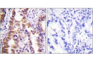 Image no. 2 for anti-Tuberous Sclerosis 2 (TSC2) (AA 905-954) antibody (ABIN1532423)
