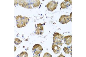 Tubulin, beta 8 抗体