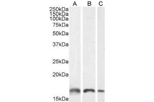 Image no. 14 for anti-Allograft Inflammatory Factor 1 (AIF1) (C-Term) antibody (ABIN184738)