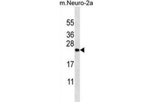 Image no. 2 for anti-Zinc Finger CCHC-Type and RNA Binding Motif 1 (ZCRB1) (AA 183-212), (C-Term) antibody (ABIN955644)