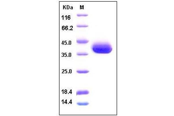 Secreted Frizzled-Related Protein 1 (SFRP1) (AA 1-314) (Active) protein (His tag)