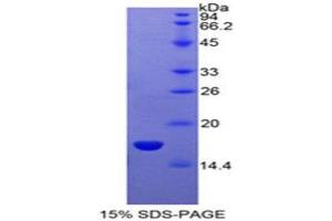 Image no. 1 for Sema Domain, Immunoglobulin Domain (Ig), Short Basic Domain, Secreted, (Semaphorin) 3A (SEMA3A) (AA 31-141) protein (His tag) (ABIN1880056)