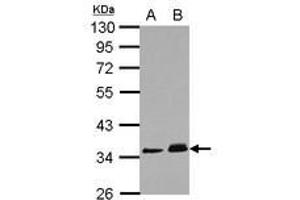 Image no. 1 for anti-Protein Phosphatase 1J (PPM1J) (AA 133-442) antibody (ABIN1500379)