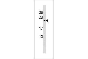 Image no. 1 for anti-Protein CutA (CUTA) (AA 116-144), (C-Term) antibody (ABIN1881242)