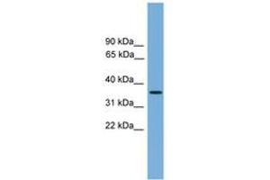 Image no. 1 for anti-Sprouty RTK Signaling Antagonist 4 (SPRY4) (C-Term) antibody (ABIN6744890)