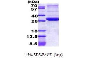 Image no. 1 for Peroxisomal Biogenesis Factor 26 (PEX26) (AA 1-246) protein (His tag) (ABIN5853072)