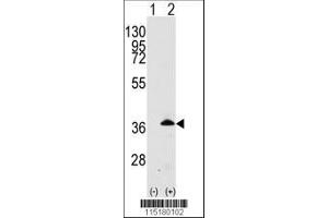 Image no. 2 for anti-Apolipoprotein E (APOE) (AA 263-292), (C-Term) antibody (ABIN391849)