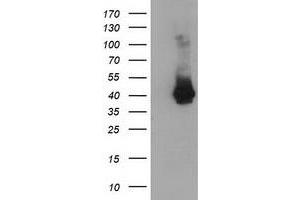 Image no. 3 for anti-Melanoma Antigen Family B, 18 (MAGEB18) antibody (ABIN2725205)