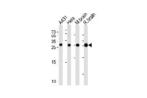 Image no. 1 for anti-14-3-3 gamma (YWHAG1) (AA 63-92), (N-Term) antibody (ABIN5535951)