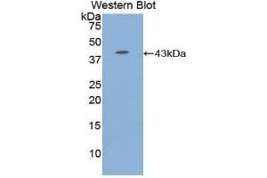 Image no. 1 for anti-Complement Component 8, beta Polypeptide (C8B) (AA 162-504) antibody (ABIN1858201)