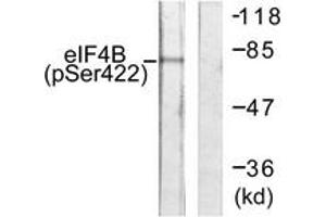 Western blot analysis of extracts from NIH-3T3 cells, using eIF4B (Phospho-Ser422) Antibody.