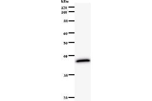 Image no. 1 for anti-Nei Endonuclease VIII-Like 3 (NEIL3) antibody (ABIN931131)