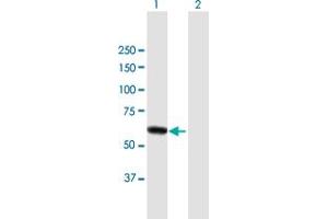 Image no. 1 for anti-Dihydropyrimidinase-Like 4 (DPYSL4) (AA 1-572) antibody (ABIN948962)