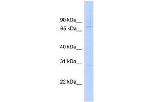 Image no. 1 for anti-EF-Hand Domain (C-terminal) Containing 1 (EFHC1) (N-Term) antibody (ABIN2785542)