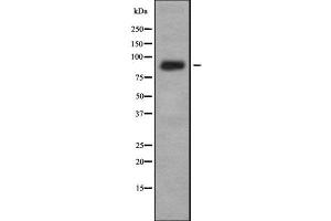 Image no. 3 for anti-Interleukin 4 Receptor (IL4R) (N-Term) antibody (ABIN6262528)