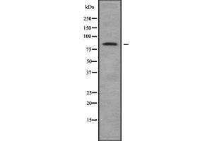 Image no. 1 for anti-Catenin (Cadherin-Associated Protein), alpha-Like 1 (CTNNAL1) (Internal Region) antibody (ABIN6261091)