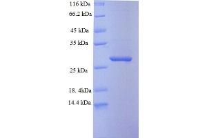 Image no. 1 for SAM Domain and HD Domain 1 (SAMHD1) (AA 395-626) protein (His tag) (ABIN5710314)