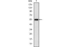 Image no. 2 for anti-Mitogen-Activated Protein Kinase Kinase Kinase 5 (MAP3K5) antibody (ABIN969273)